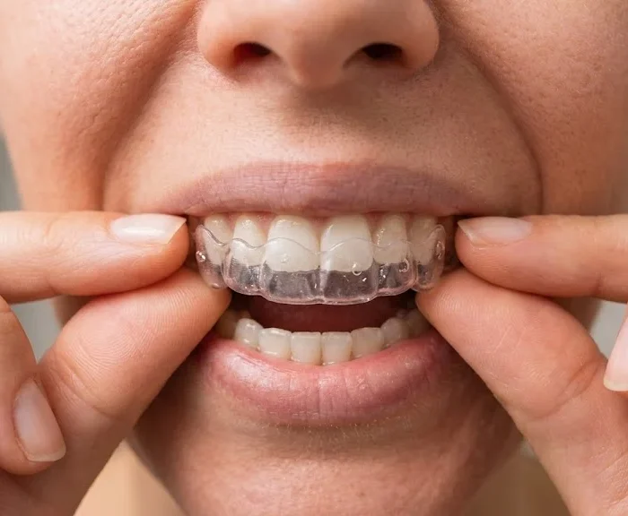 Whitening Strips